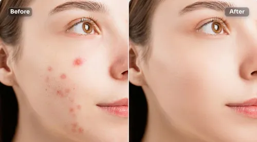 روتوش (ریتاچ)